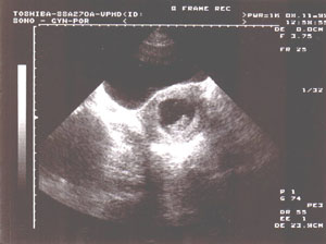 eMiminko - 10. měsíc